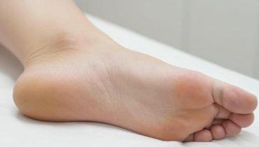 Verruche plantari: 5 rimedi naturali validati per eliminarle senza chirurgia né prodotti chimici